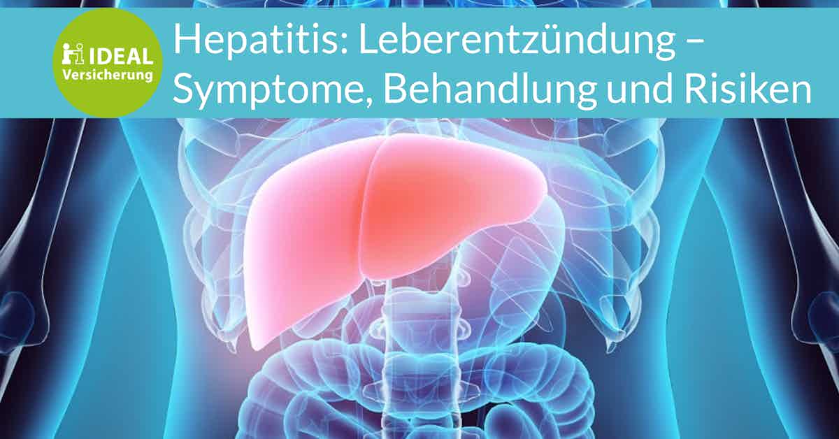 Hepatitis: Leberentzündung – Symptome, Behandlung und Risiken I Magazin IDEAL Versicherung