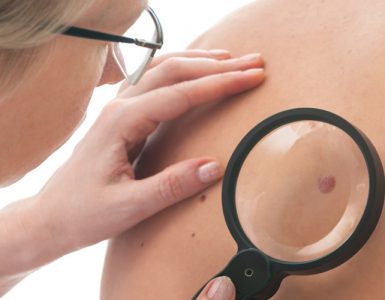 Dermatologin schaut sich ein Muttermal eines Patienten genauer an.