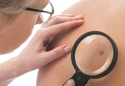 Dermatologin schaut sich ein Muttermal eines Patienten genauer an.
