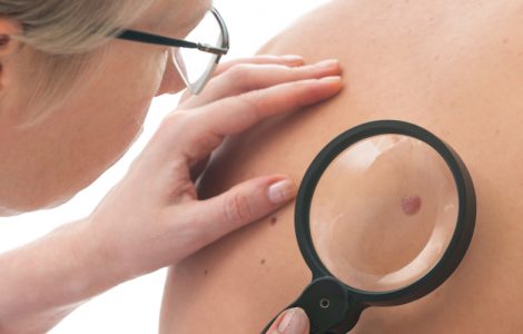 Dermatologin schaut sich ein Muttermal eines Patienten genauer an.