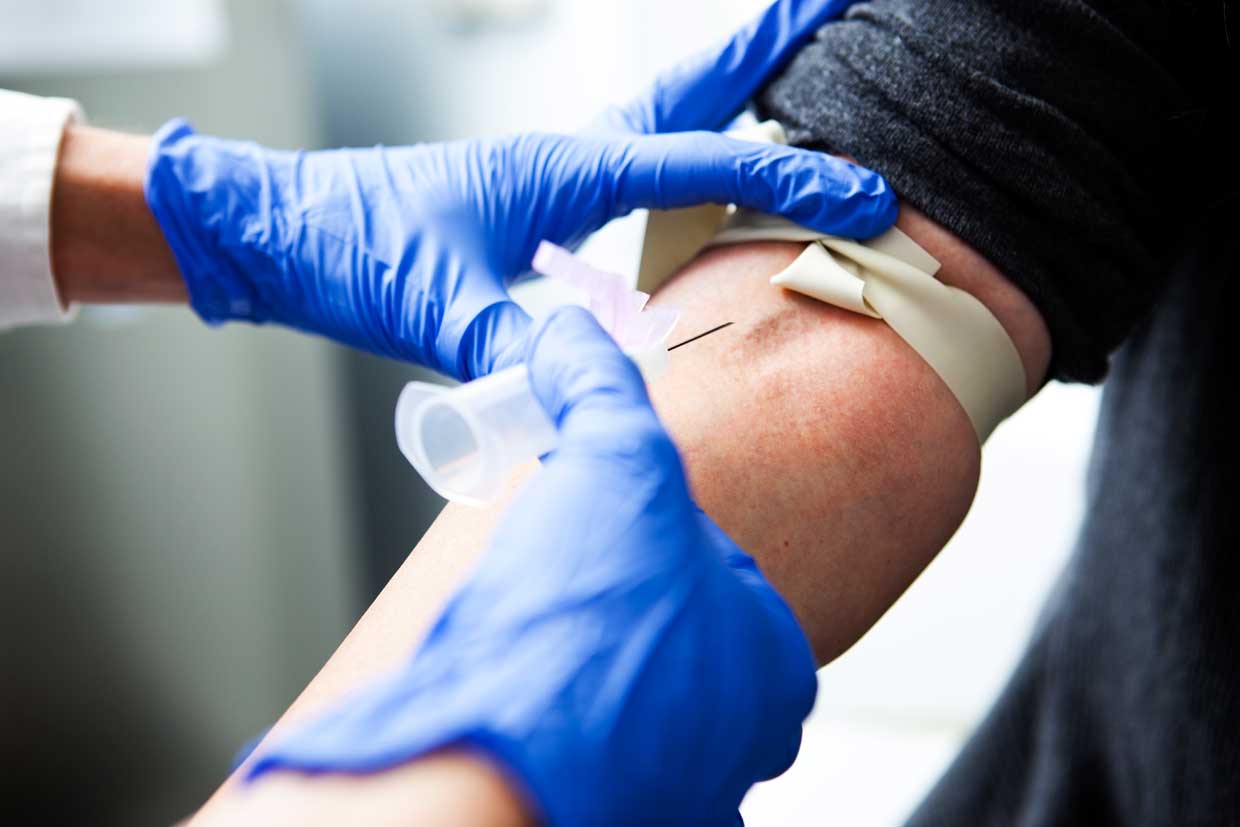 Blutabnahme für einen PSA-Test