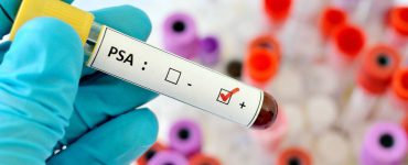 Blutprobe zur PSA Bestimmung